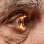 Close-up of an eye on an ophthalmology examination of an elderly man.