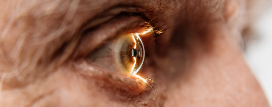 Close-up of an eye on an ophthalmology examination of an elderly man.