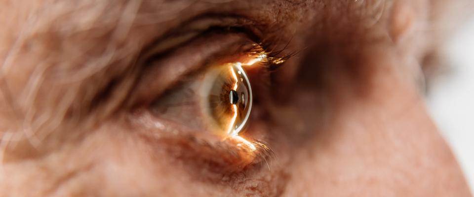 Close-up of an eye on an ophthalmology examination of an elderly man.